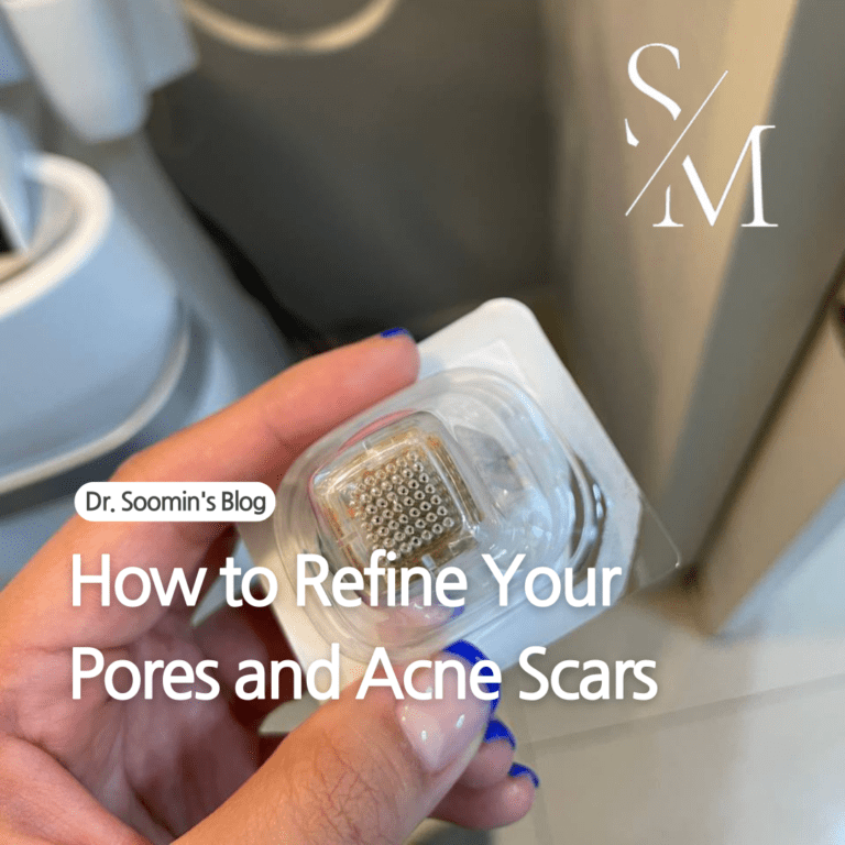 Close-up of a Potenza Needle RF tip used for pore tightening and acne scar treatment